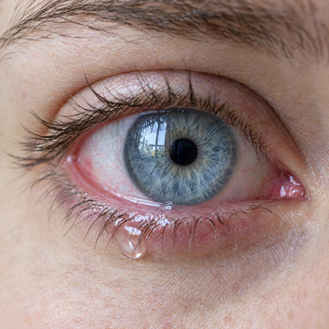 Close-up of a watery, irritated eye